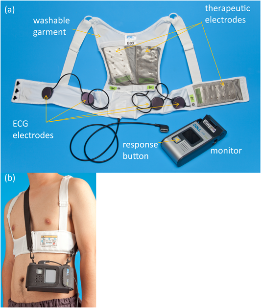 Pediatric Cardiology and Cardiac Surgery 33(3) 228233 (2017)