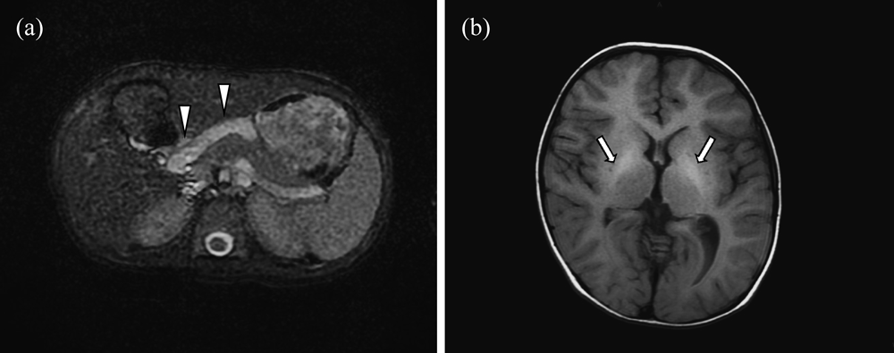 Pediatric Cardiology and Cardiac Surgery 31(4): 212-219 (2015)
