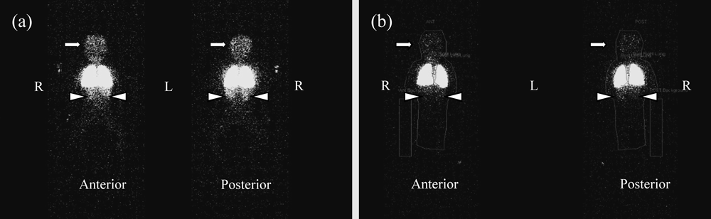 Pediatric Cardiology and Cardiac Surgery 31(4): 212-219 (2015)