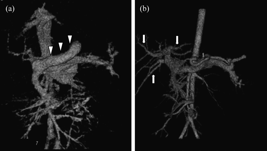 Pediatric Cardiology and Cardiac Surgery 31(4): 212-219 (2015)