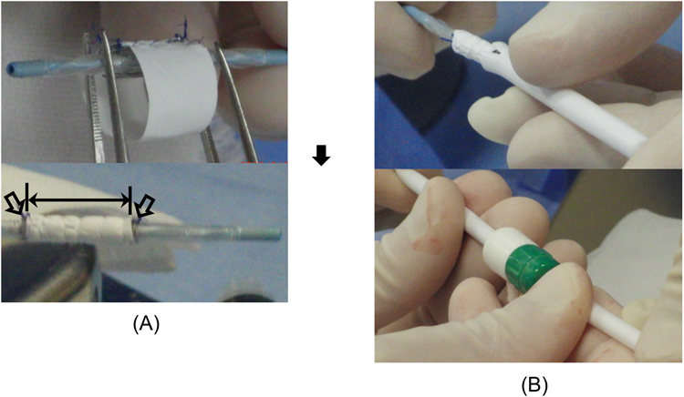 Pediatric Cardiology and Cardiac Surgery 31(5): 271-277 (2015)