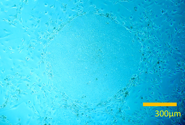 Pediatric Cardiology and Cardiac Surgery 31(6): 313-319 (2015)