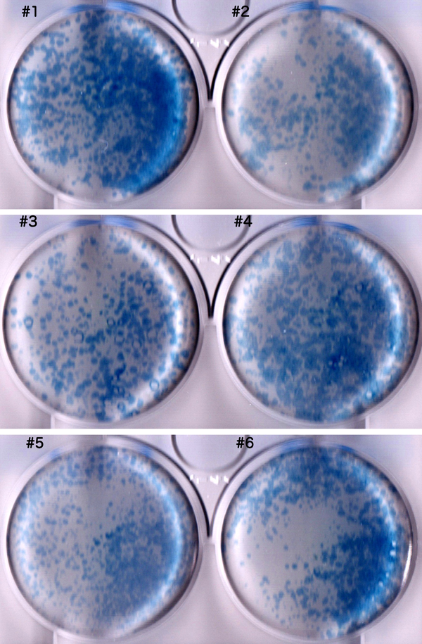Pediatric Cardiology and Cardiac Surgery 31(6): 313-319 (2015)