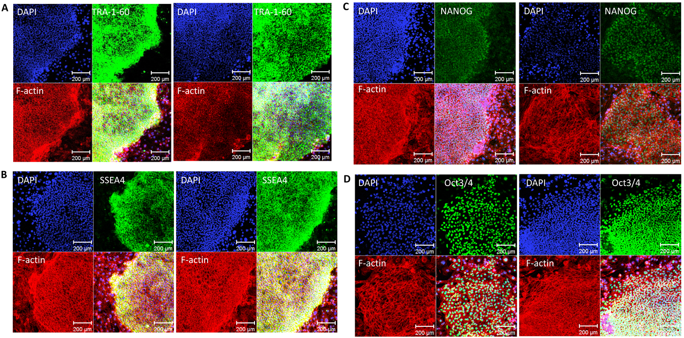 Pediatric Cardiology and Cardiac Surgery 31(6): 313-319 (2015)