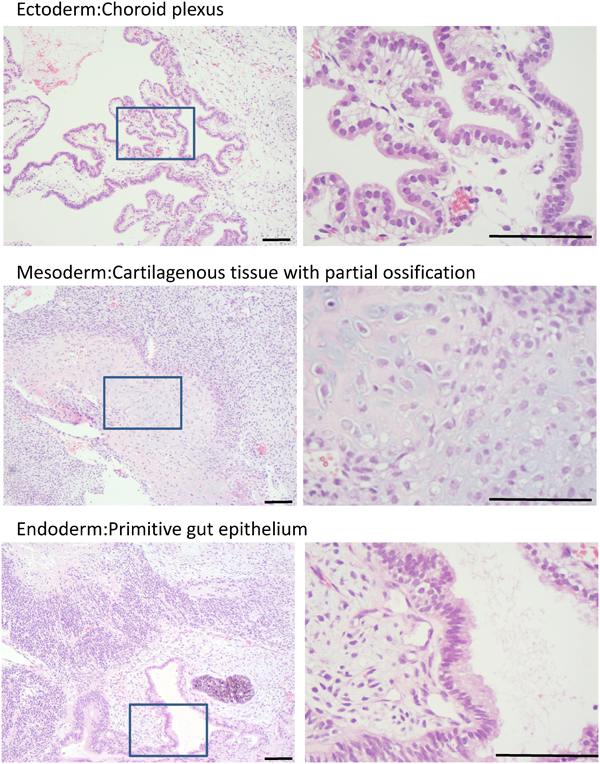 Pediatric Cardiology and Cardiac Surgery 31(6): 313-319 (2015)