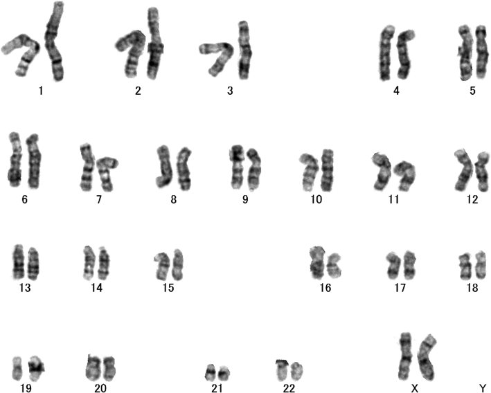 Pediatric Cardiology and Cardiac Surgery 31(6): 313-319 (2015)