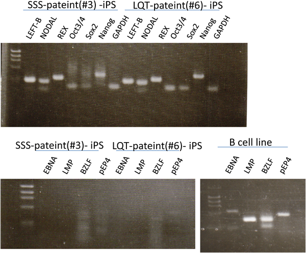 Pediatric Cardiology and Cardiac Surgery 31(6): 313-319 (2015)