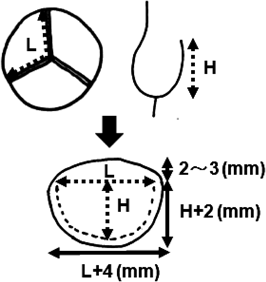 Pediatric Cardiology and Cardiac Surgery 31(6): 329-337 (2015)