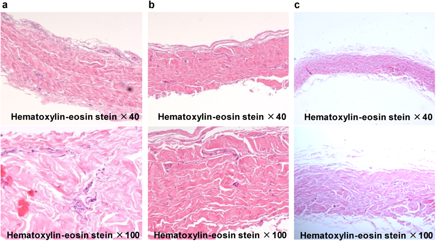 Pediatric Cardiology and Cardiac Surgery 31(6): 329-337 (2015)