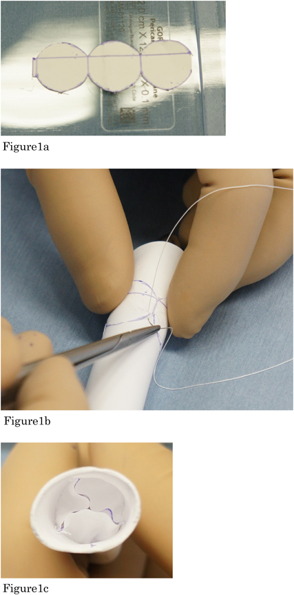 Pediatric Cardiology and Cardiac Surgery 31(6): 340-344 (2015)