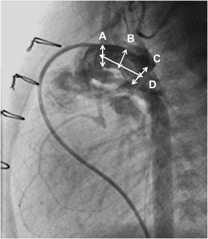 Pediatric Cardiology and Cardiac Surgery 31(1-2): 9-19 (2015)