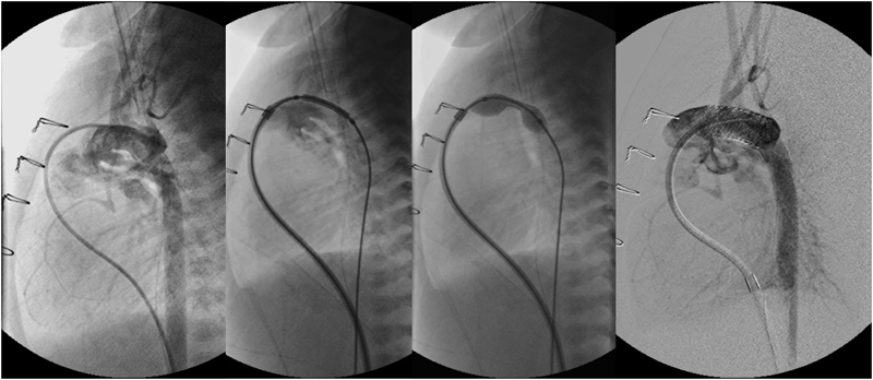 Pediatric Cardiology and Cardiac Surgery 31(1-2): 9-19 (2015)