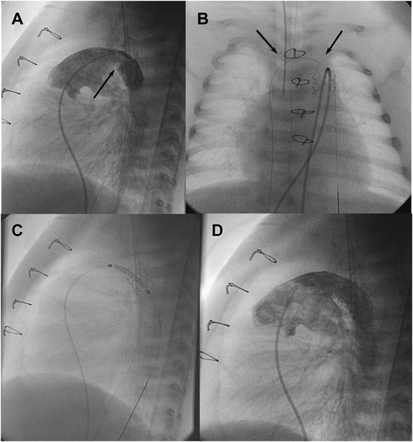 Pediatric Cardiology and Cardiac Surgery 31(1-2): 9-19 (2015)