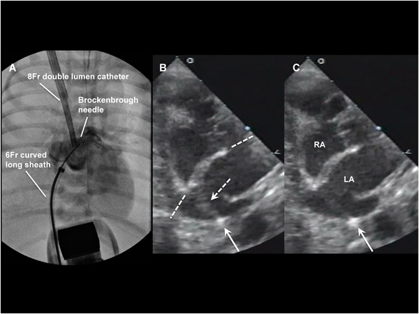 Pediatric Cardiology and Cardiac Surgery 31(1-2): 9-19 (2015)