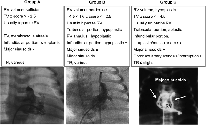 Pediatric Cardiology and Cardiac Surgery 31(1-2): 9-19 (2015)