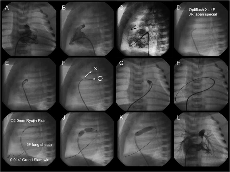 Pediatric Cardiology and Cardiac Surgery 31(1-2): 9-19 (2015)