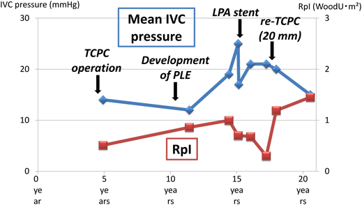 Pediatric Cardiology and Cardiac Surgery 32(5): 432-436 (2016)