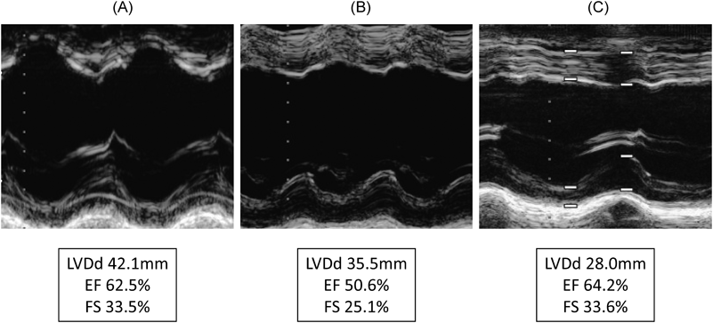 Pediatric Cardiology and Cardiac Surgery 32(6): 518-523 (2016)