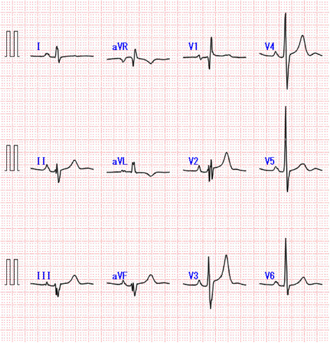 Pediatric Cardiology and Cardiac Surgery 32(6): 527-533 (2016)