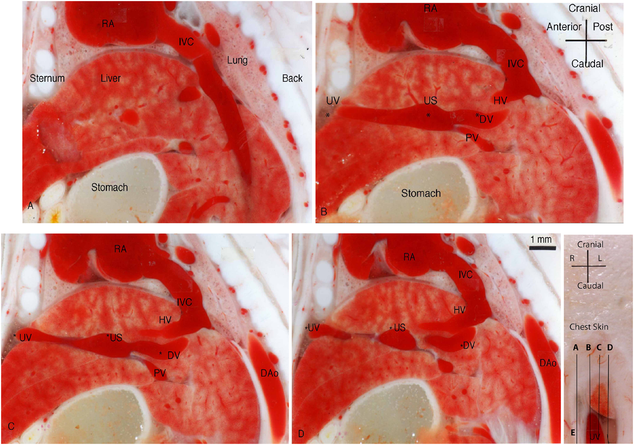 Pediatric Cardiology and Cardiac Surgery 34(4): 165-171 (2018)