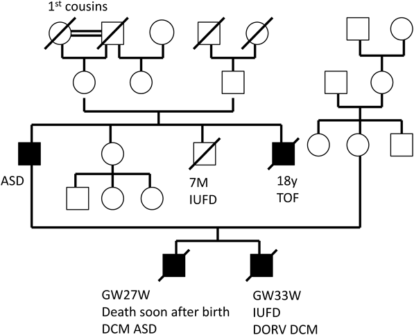 Pediatric Cardiology and Cardiac Surgery 34(1): 39-45 (2018)