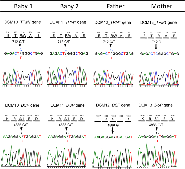 Pediatric Cardiology and Cardiac Surgery 34(1): 39-45 (2018)