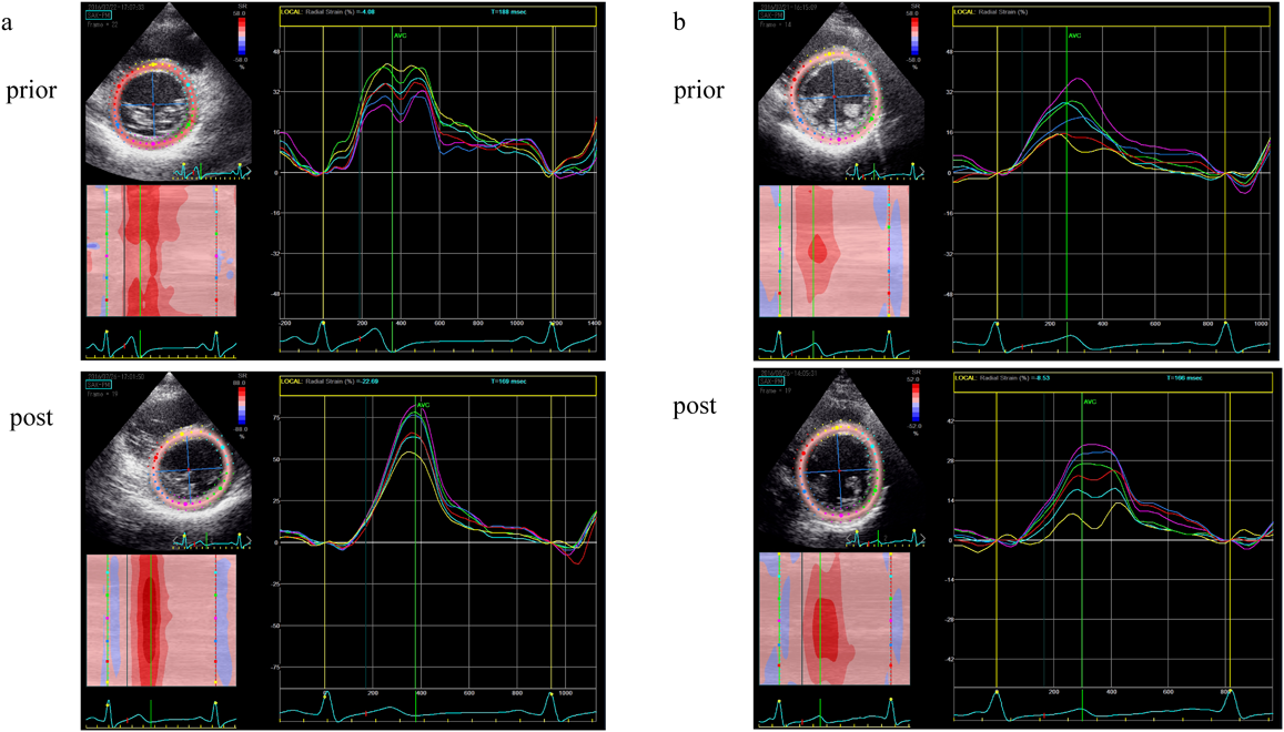 Pediatric Cardiology and Cardiac Surgery 34(2): 63-71 (2018)