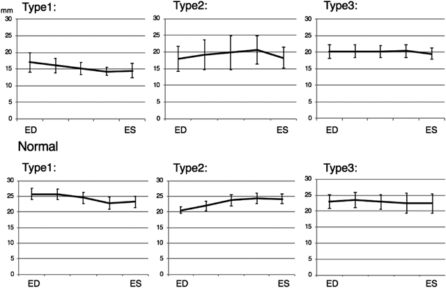 Pediatric Cardiology and Cardiac Surgery 35(1): 30-37 (2019)