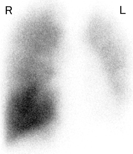 Pediatric Cardiology and Cardiac Surgery 36(2): 152-156 (2020)