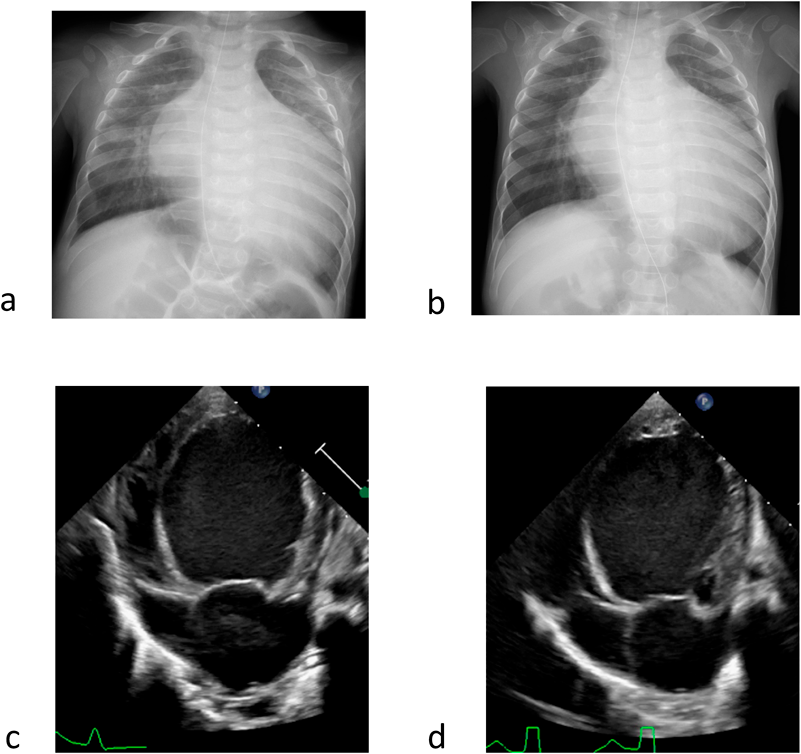Pediatric Cardiology and Cardiac Surgery 36(3): 256-262 (2020)