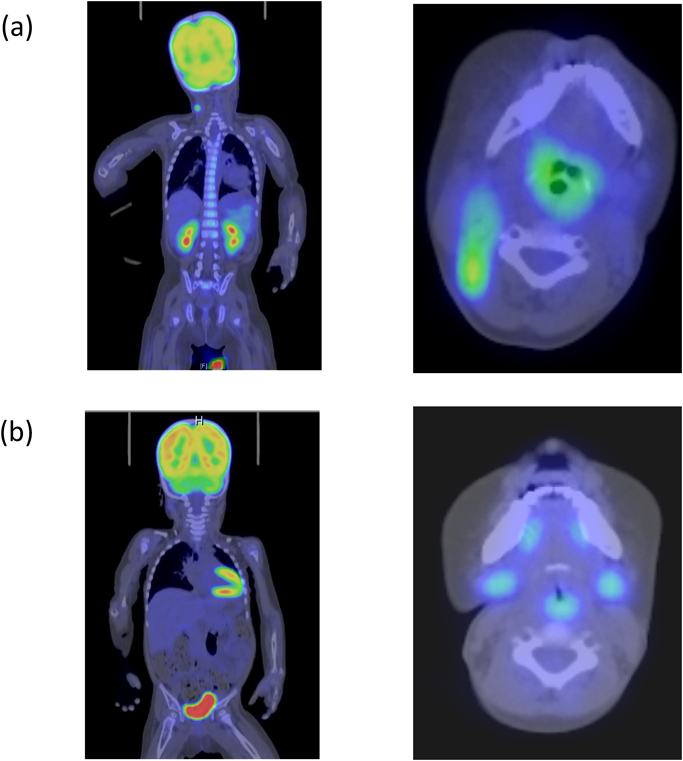 Pediatric Cardiology and Cardiac Surgery 37(2): 133-140 (2021)
