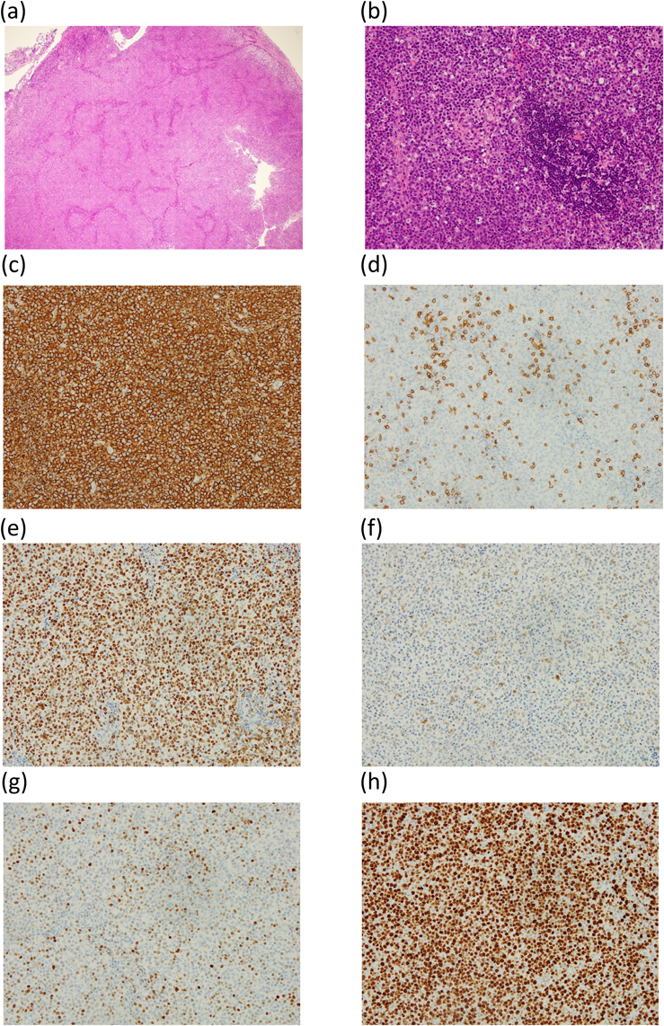 Pediatric Cardiology and Cardiac Surgery 37(2): 133-140 (2021)