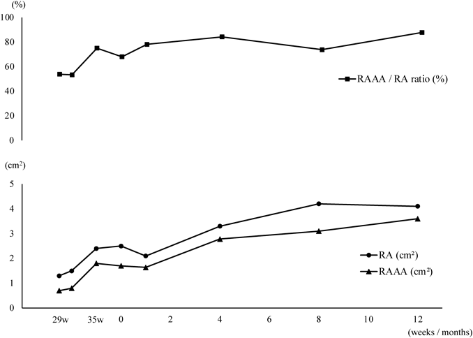 Pediatric Cardiology and Cardiac Surgery 38(3): 198-203 (2022)