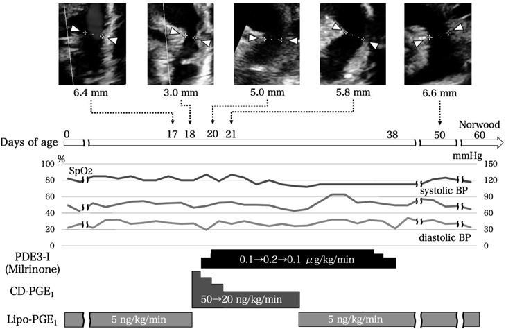 Pediatric Cardiology and Cardiac Surgery 39(1): 25-30 (2023)