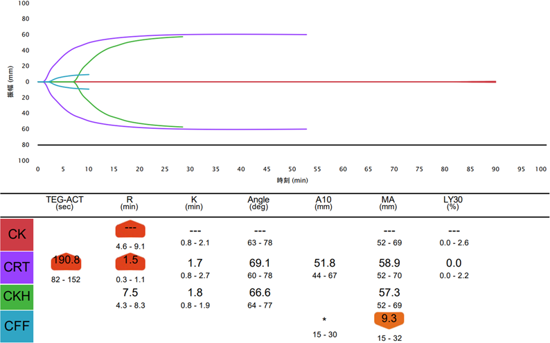Pediatric Cardiology and Cardiac Surgery 39(1): 39-45 (2023)