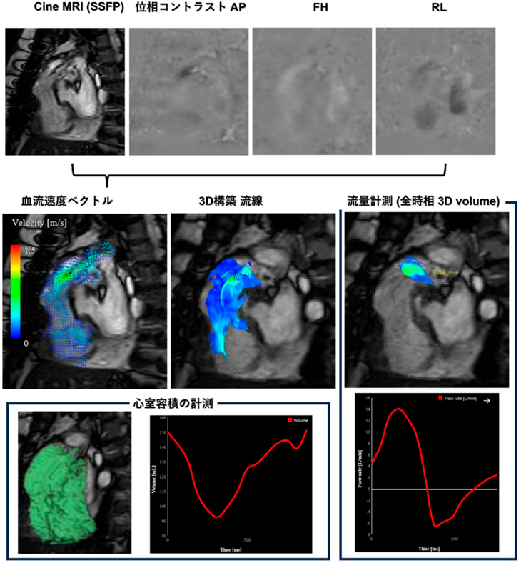 Pediatric Cardiology and Cardiac Surgery 40(3): 186-192 (2024)