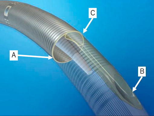Pediatric Cardiology and Cardiac Surgery 41(1): 51-57 (2025)