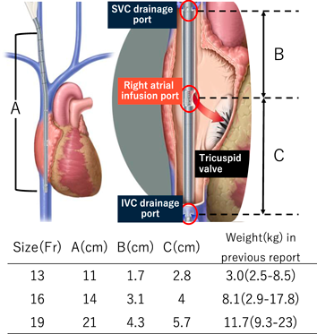 Pediatric Cardiology and Cardiac Surgery 41(1): 51-57 (2025)